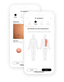 Dermafy App Screenshot Dermafy App Screenshot